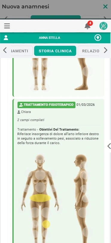 Timeline con zoom a due livelli