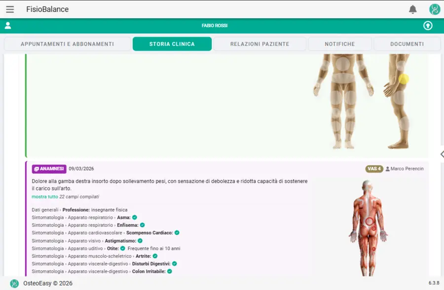 Timeline con zoom a due livelli